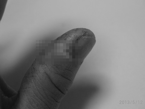 20130512_kizu-1a.jpg