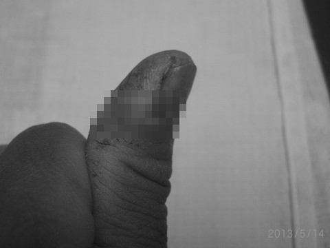 20130513_kizu-1b.jpg